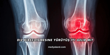 Diz Kireçlenmesine Yürüyüş İyi Gelir mi?