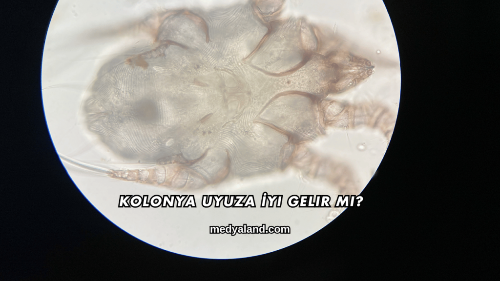 Kolonya Uyuza İyi Gelir mi?