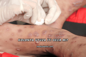 Kolonya Uyuza İyi Gelir mi?