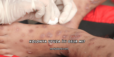 Kolonya Uyuza İyi Gelir mi?