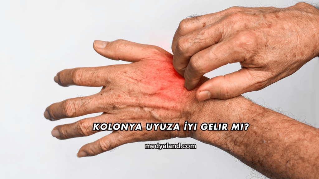 Kolonya Uyuza İyi Gelir mi?