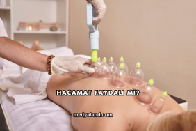 Hacamat Faydalı mı?