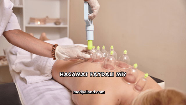 Hacamat Faydalı mı?
