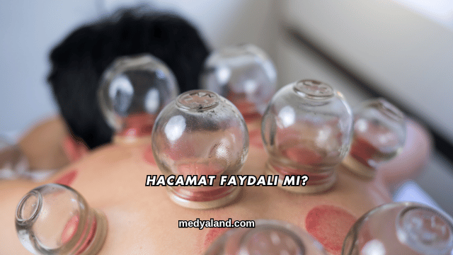 Hacamat Faydalı mı?