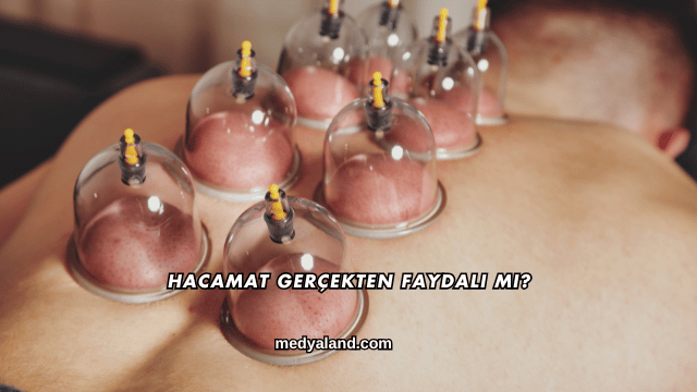 Hacamat Gerçekten Faydalı mı?