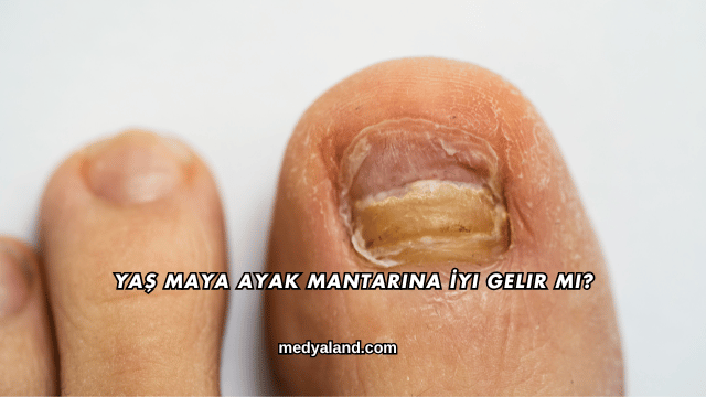 Yaş Maya Ayak Mantarına İyi Gelir mi?