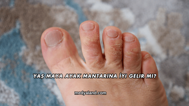 Yaş Maya Ayak Mantarına İyi Gelir mi?