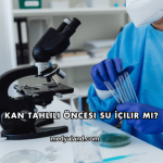 Kan Tahlili Öncesi Su İçilir mi?