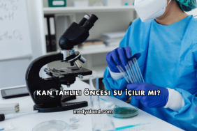 Kan Tahlili Öncesi Su İçilir mi?