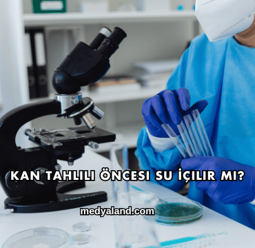 Kan Tahlili Öncesi Su İçilir mi?