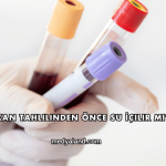 Kan Tahlilinden Önce Su İçilir mi?