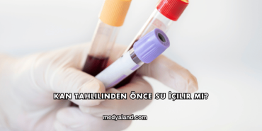 Kan Tahlilinden Önce Su İçilir mi?