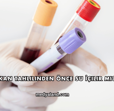 Kan Tahlilinden Önce Su İçilir mi?