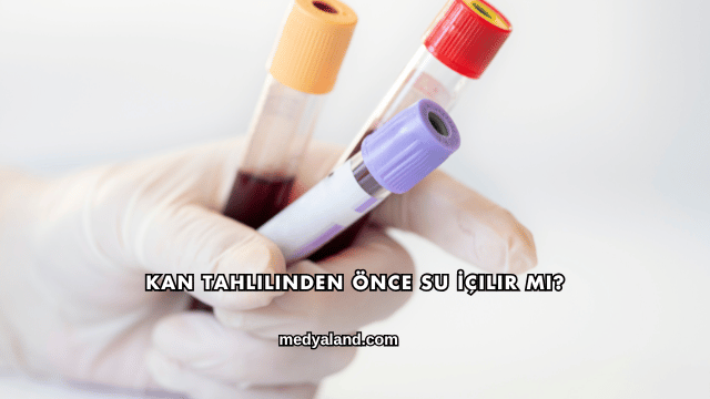 Kan Tahlilinden Önce Su İçilir mi?