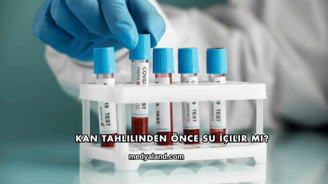 Kan Tahlilinden Önce Su İçilir mi?