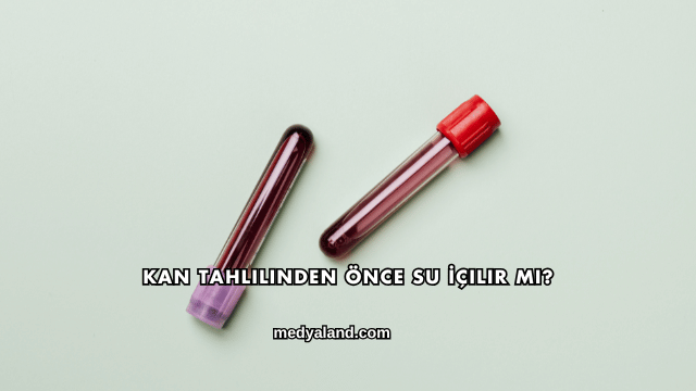 Kan Tahlilinden Önce Su İçilir mi?
