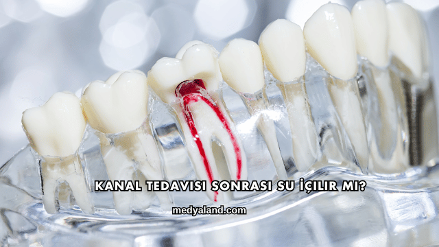 Kanal Tedavisi Sonrası Su İçilir mi?