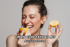 Limon Cilde Faydalı mı?