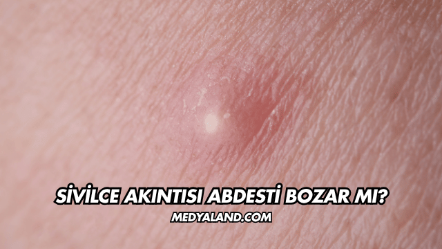 Sivilce Akıntısı Abdesti Bozar mı?