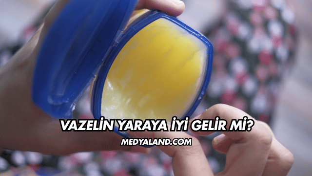 Vazelin Yaraya İyi Gelir mi?