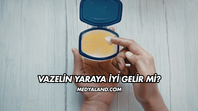 Vazelin Yaraya İyi Gelir mi?