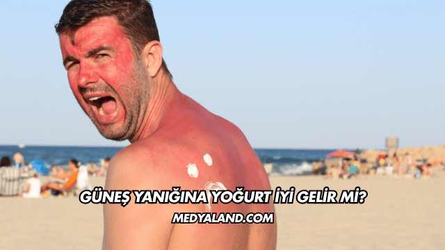 Güneş Yanığına Yoğurt İyi Gelir mi?