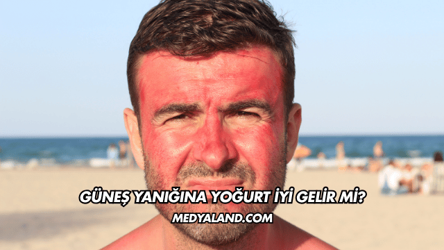 Güneş Yanığına Yoğurt İyi Gelir mi?