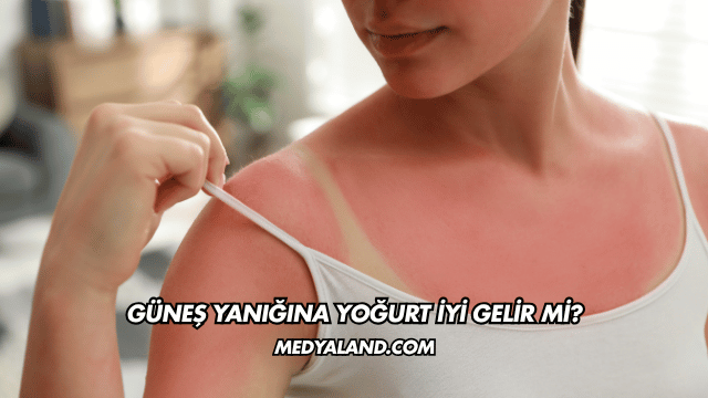 Güneş Yanığına Yoğurt İyi Gelir mi?