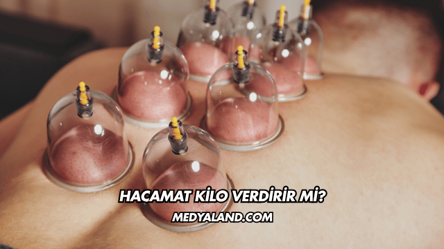 Hacamat Kilo Verdirir mi?