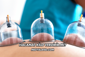 Hacamat Kilo Verdirir mi?