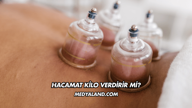 Hacamat Kilo Verdirir mi?